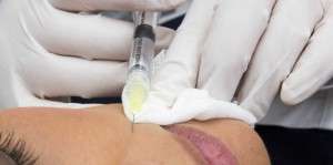 Tratamiento Dermatología Estética en Novaderma, Dermatólogo en Tomares, Sevilla