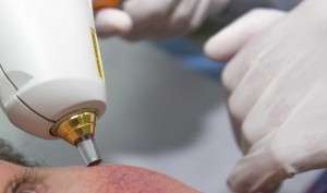 Tratamiento Dermatología Médico Quirúrgica en Novaderma, Dermatólogo en Tomares, Sevilla.