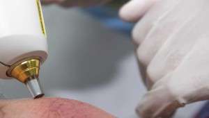 Tratamiento Dermatología Médico Quirúrgica en Novaderma, Dermatólogo en Tomares, Sevilla.