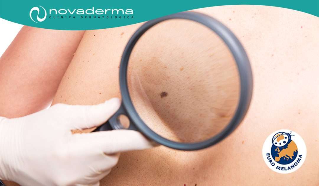 Novaderma con Euromelanoma 2018